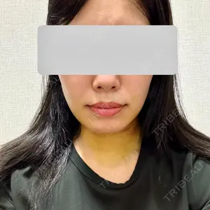 口コミ