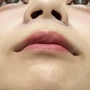 渋谷の森クリニック口コミ