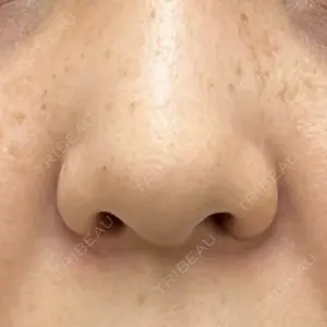 渋谷の森クリニック口コミ