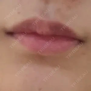 Kinshicho Beauty Clinic （錦糸町ビューティークリニック）口コミ