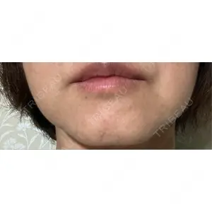 湘南美容クリニック 湘南美容クリニック 新宿本院口コミ