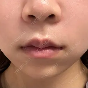 BiBiクリニック口コミ