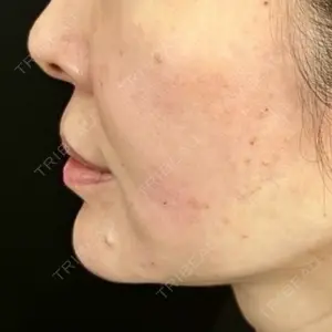 藤・ナチュレ美容クリニック 藤・ナチュレ美容クリニック 銀座院口コミ