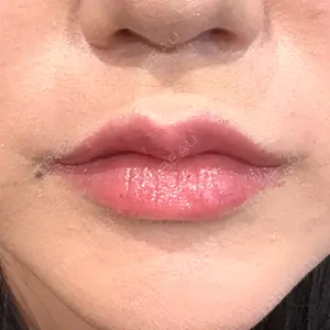 R Beauty CLINIC R Beauty CLINIC 銀座院口コミ