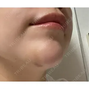 HAAB×DREAM BEAUTY CLINIC HAAB×DREAM BEAUTY CLINIC 大阪梅田院口コミ