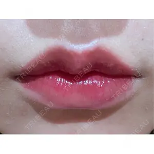 R Beauty CLINIC R Beauty CLINIC 銀座院口コミ