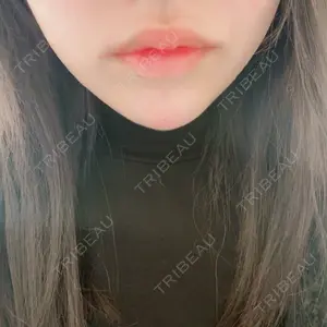 MIO CLINIC 梅田院口コミ