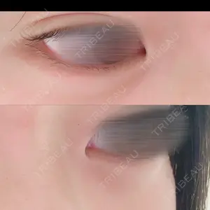 MIO CLINIC 梅田院口コミ