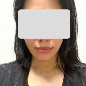 口コミ