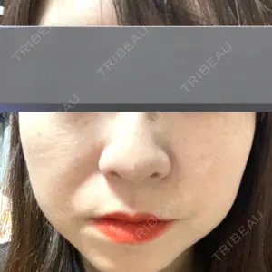 口コミ