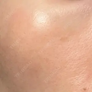 エルムクリニック 美容皮膚科エルムクリニック 広島院口コミ