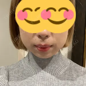 口コミ