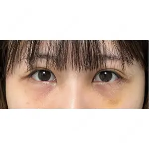 藤・ナチュレ美容クリニック 藤・ナチュレ美容クリニック 銀座院口コミ