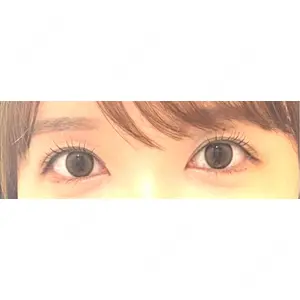 エイペックス美容外科の