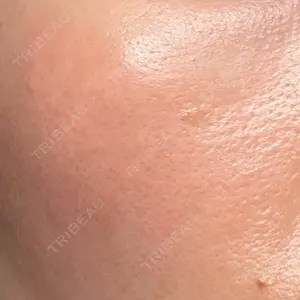 エルムクリニック 美容皮膚科エルムクリニック 広島院口コミ