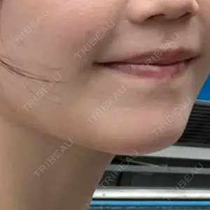 聖心美容クリニック グループ S-Laboクリニック 渋谷院口コミ