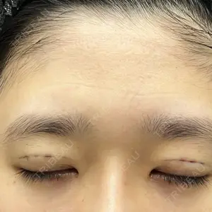 渋谷の森クリニック口コミ