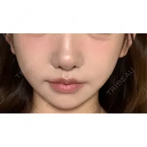 L‘amour clinic Tokyo【ラムールクリニック東京】口コミ