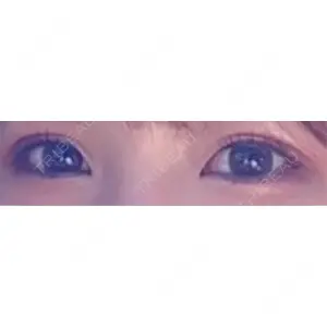 東京イセアクリニック口コミ