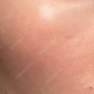 エルムクリニック 美容皮膚科エルムクリニック 広島院口コミ