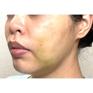 藤・ナチュレ美容クリニック 藤・ナチュレ美容クリニック 銀座院口コミ