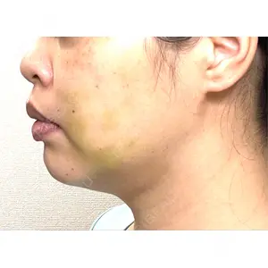 藤・ナチュレ美容クリニック 藤・ナチュレ美容クリニック 銀座院口コミ