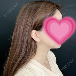 藤・ナチュレ美容クリニック 藤・ナチュレ美容クリニック 銀座院口コミ