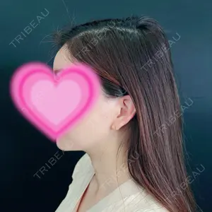 藤・ナチュレ美容クリニック 藤・ナチュレ美容クリニック 銀座院口コミ