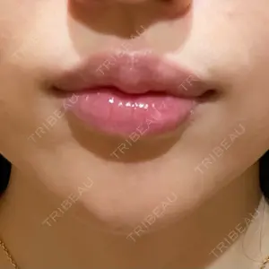 R Beauty CLINIC R Beauty CLINIC 銀座院口コミ