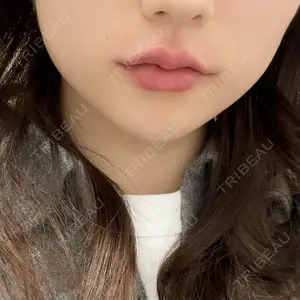 R Beauty CLINIC R Beauty CLINIC 銀座院口コミ
