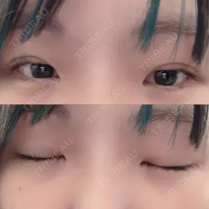 口コミ