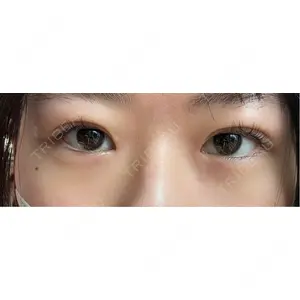 東京シンデレラ美容外科 東京シンデレラ美容外科 池袋院口コミ