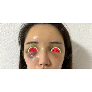 NARU Beauty Clinic NARU Beauty Clinic 【ナルクリ】 水戸院口コミ