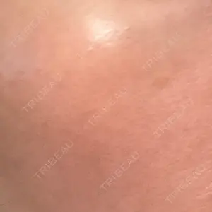 エルムクリニック 美容皮膚科エルムクリニック 広島院口コミ