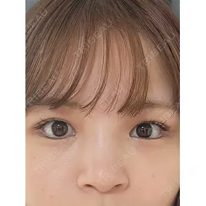 口コミ