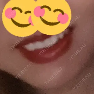 BiBiクリニック口コミ