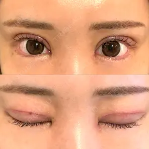 口コミ