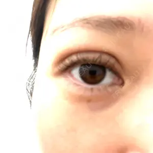 CHARIS BEAUTY CLINIC口コミ