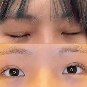 口コミ