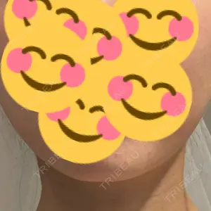 BiBiクリニック口コミ