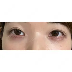 東京シンデレラ美容外科 東京シンデレラ美容外科 池袋院口コミ