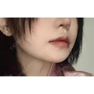 L‘amour clinic Tokyo【ラムールクリニック東京】口コミ