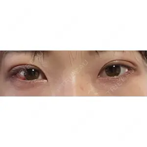 口コミ