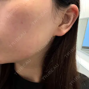 ルラ美容クリニック ルラ美容クリニック 新宿院口コミ