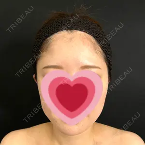 藤・ナチュレ美容クリニック 藤・ナチュレ美容クリニック 銀座院口コミ