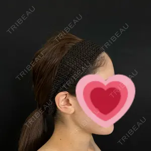 藤・ナチュレ美容クリニック 藤・ナチュレ美容クリニック 銀座院口コミ
