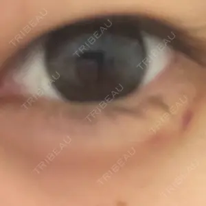 銀座リシェスクリニック口コミ