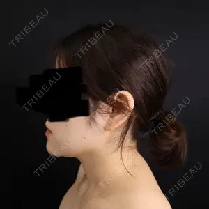 藤・ナチュレ美容クリニック 藤・ナチュレ美容クリニック 銀座院口コミ
