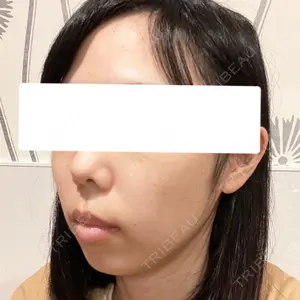 口コミ