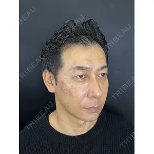 藤・ナチュレ美容クリニック 藤・ナチュレ美容クリニック 銀座院口コミ